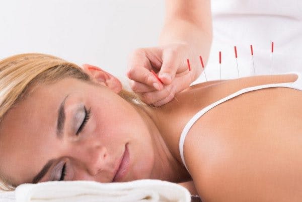 spinal cord injury patient using acupuncture for pain relief