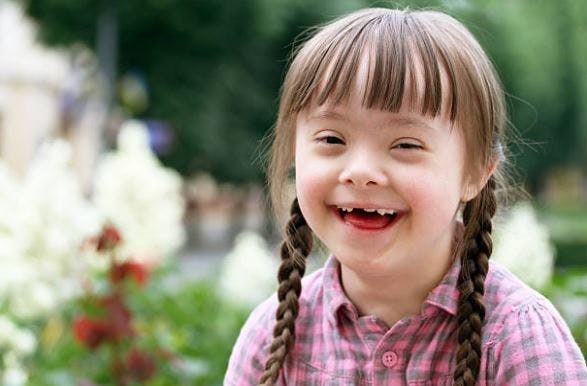 physical effects of cerebral palsy vs down syndrome